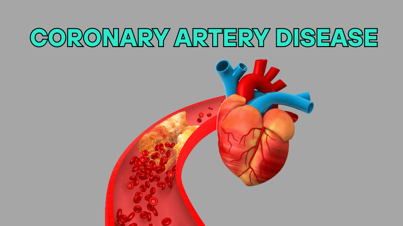 coronary artery disease -doctor sahab