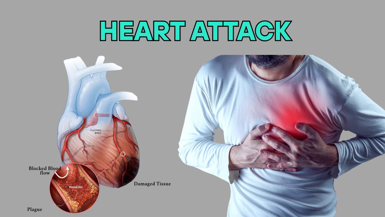 HEART ATTACK - DOCTOR SAHAB