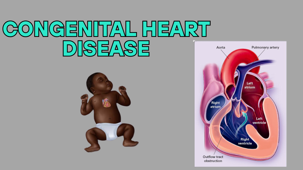 congenital heart disease - DOCTOR SAHAB
