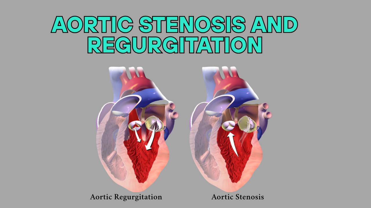 Aortic Stenosis and Regurgitation - doctor sahab